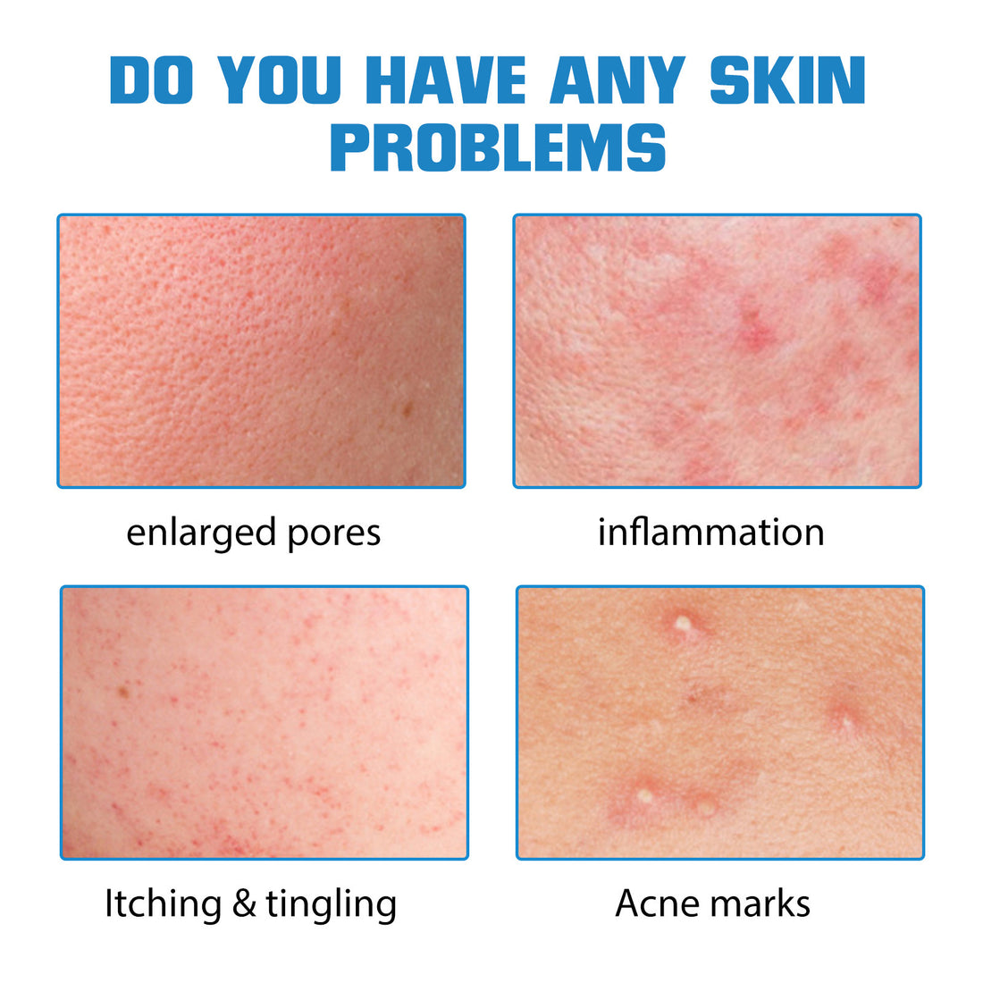 Hyaluronic Acid Replenishment